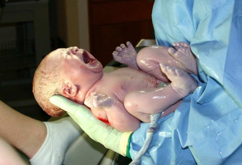 Neonata subì frattura del femore durante la nascita: condannati Asp e medico