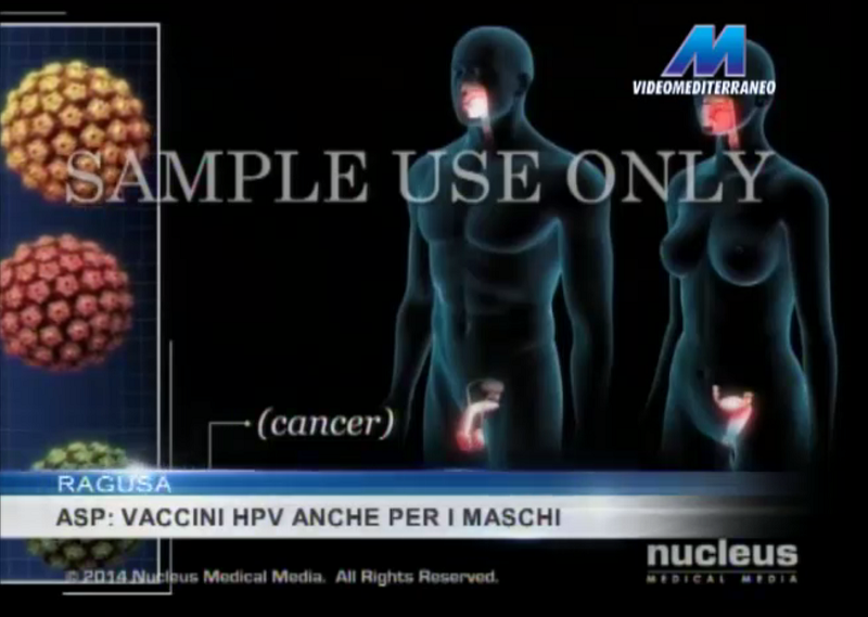 Ragusa, ASP: vaccini HPV anche per i maschi