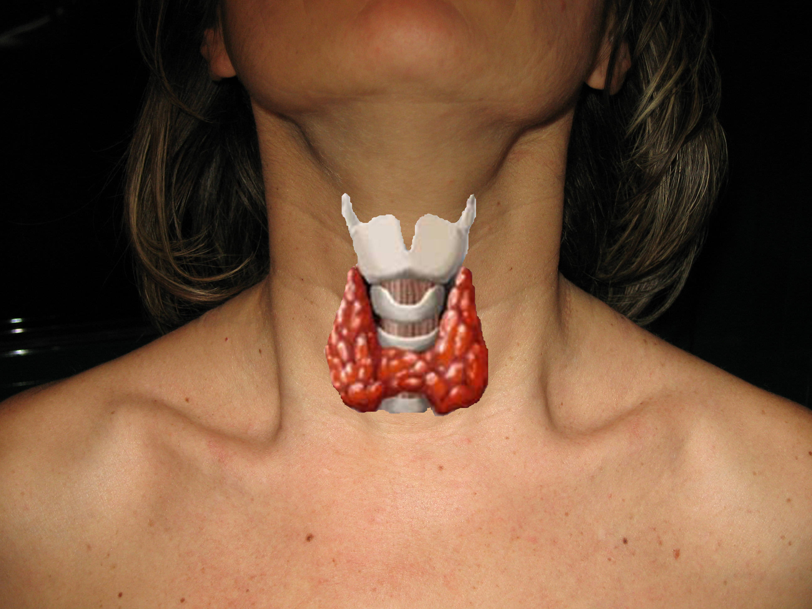 Le alterazioni della funzione tiroidea