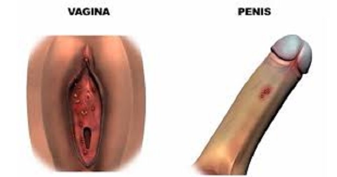 L’infezione da HPV