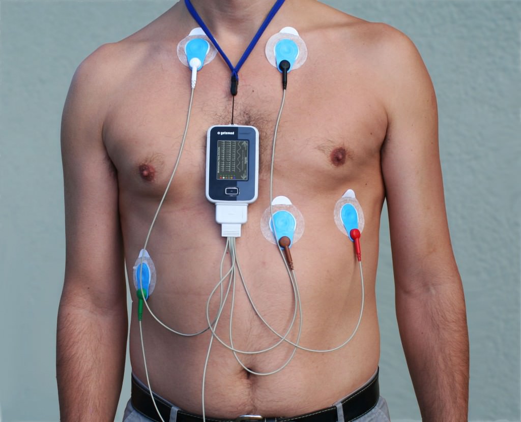 Cardiopatici siciliani di nuovo curati al pari di tutti i cittadini italiani