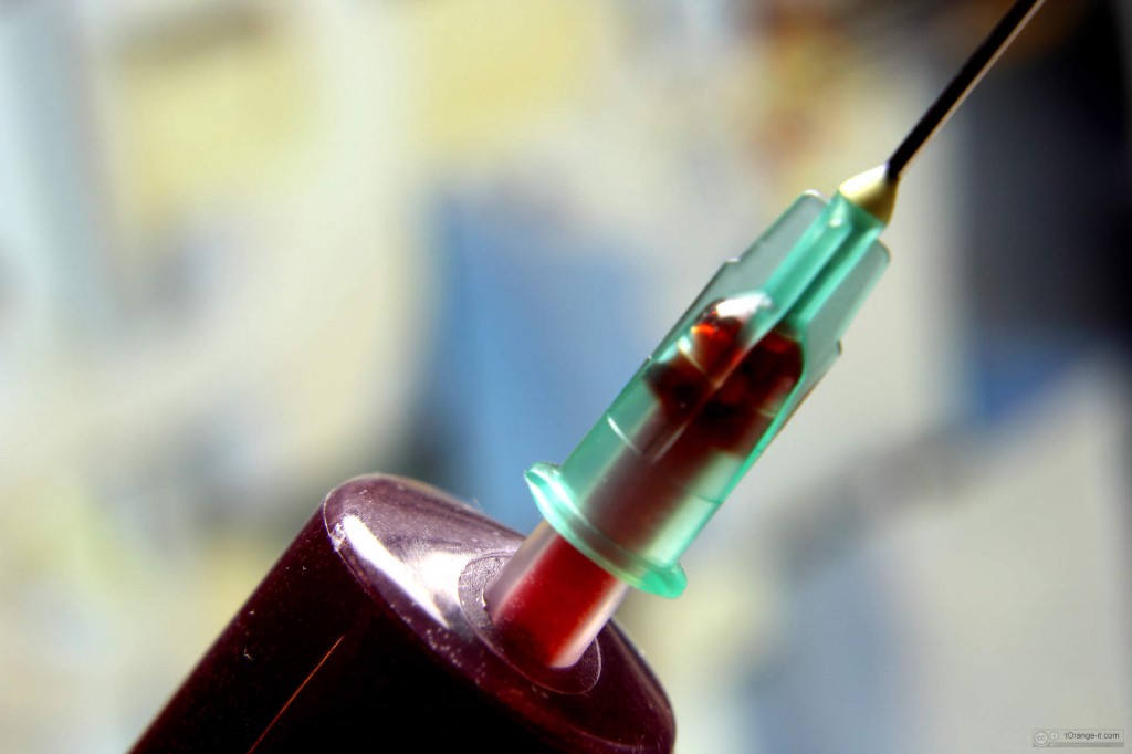Catania e la grave mancanza di sangue, i medici chiedono aiuto: “Pensate ai malati cronici che soffrono”