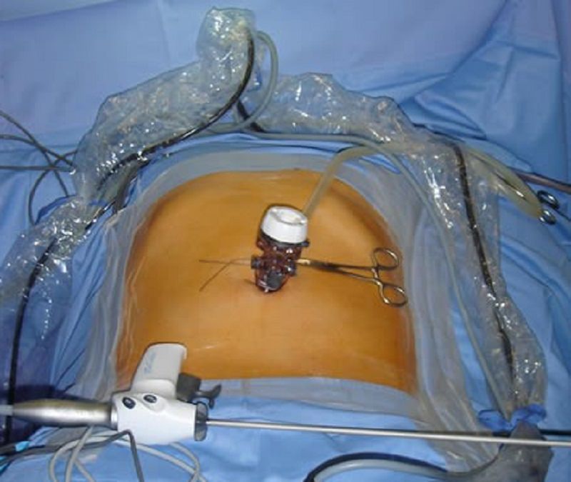 Indicazioni alla laparoscopia in chirurgia d’urgenza