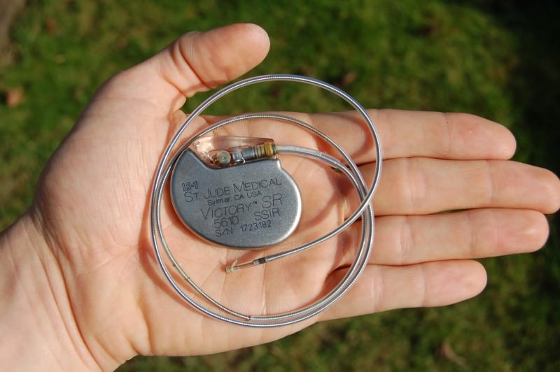 Il pacemaker: come funziona e quando si utilizza