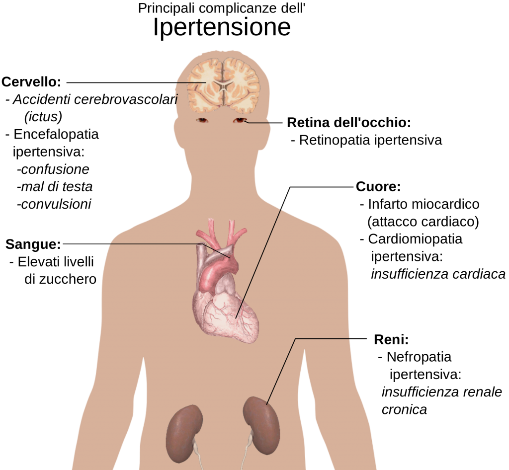 Cardiopatia ischemica e medicina generale