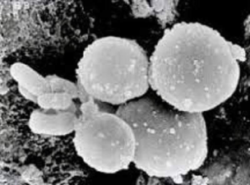 Candida: quanto incide una nutrizione equilibrata?