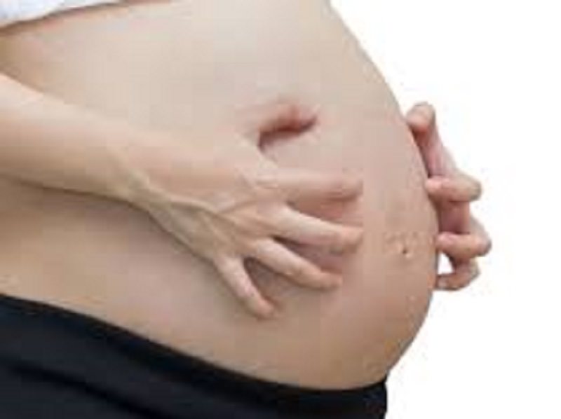 2 триместр твердый живот. Чешется живот при беременности на поздних сроках. Чешется живот от фраксипарина.