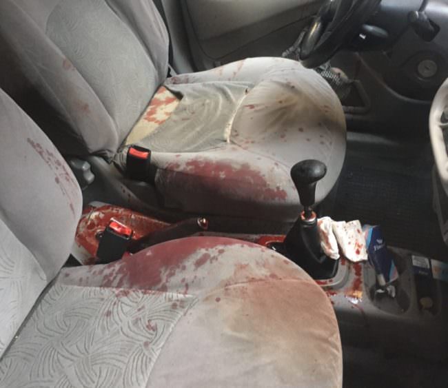 Accoltellamento in via Pistone, un uomo scende in strada pieno di sangue. IL VIDEO e le FOTO