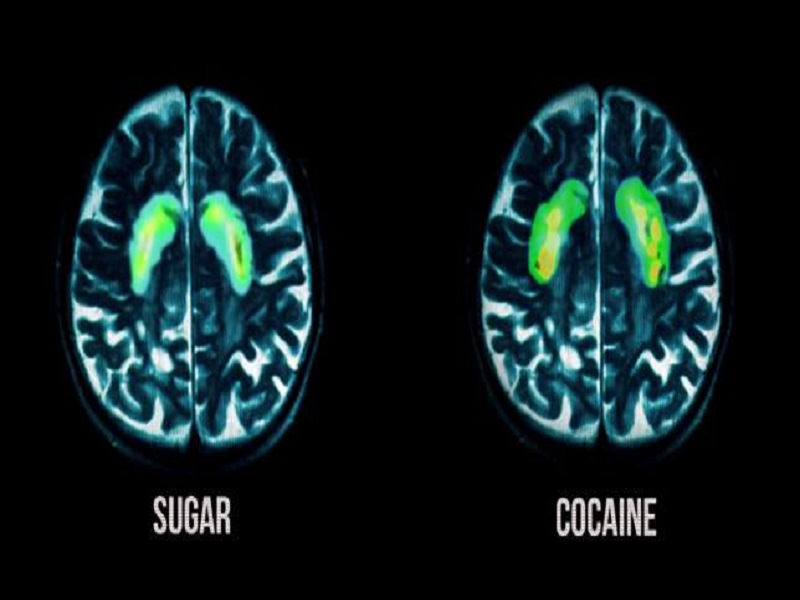 Zucchero come cocaina: per uno studio americano la dipendenza e l’astinenza sono le stesse