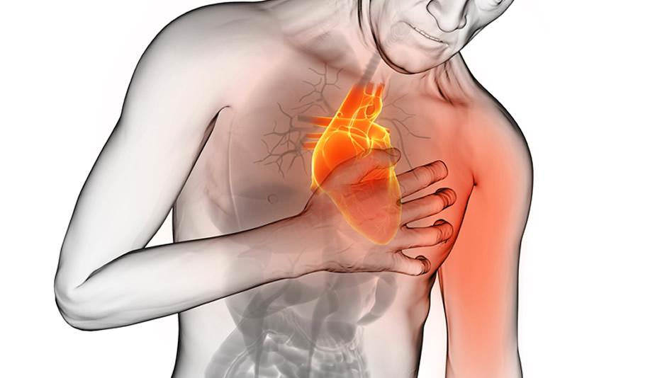 Infarto del miocardio: i farmaci necessari