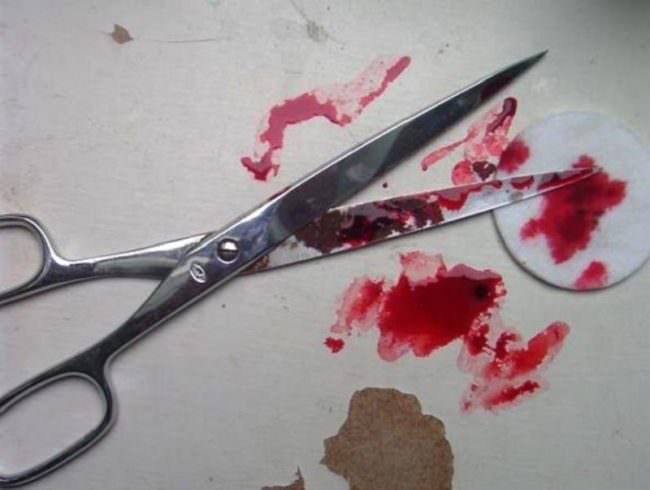 “Mi hanno pugnalata, mi sono finta morta”: il dramma dell’anziana aggredita in casa