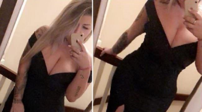 Seno rifatto si “scioglie” con l’acqua bollente: choc per una modella