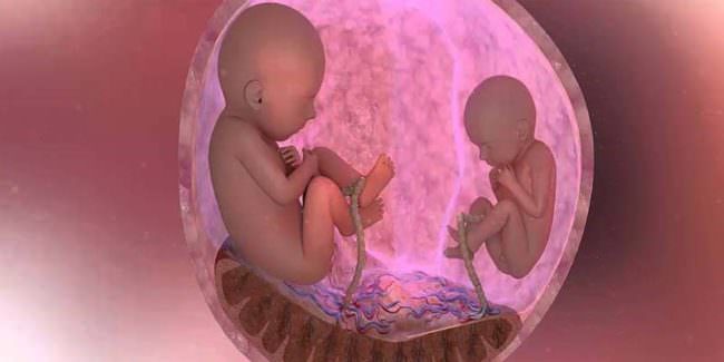 Difetto di crescita intrauterino