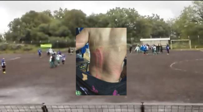 “Lo stanno ammazzando”: che rissa ad Aci Bonaccorsi! Sei feriti, tifosi scavalcano la tribuna – FOTO e VIDEO