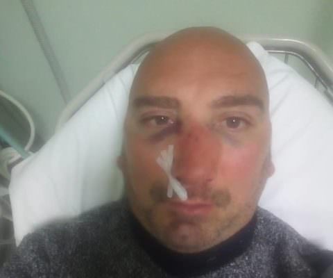 Ausiliare del traffico aggredito vicino a una scuola, solidarietà del sindaco: “Un episodio inqualificabile”