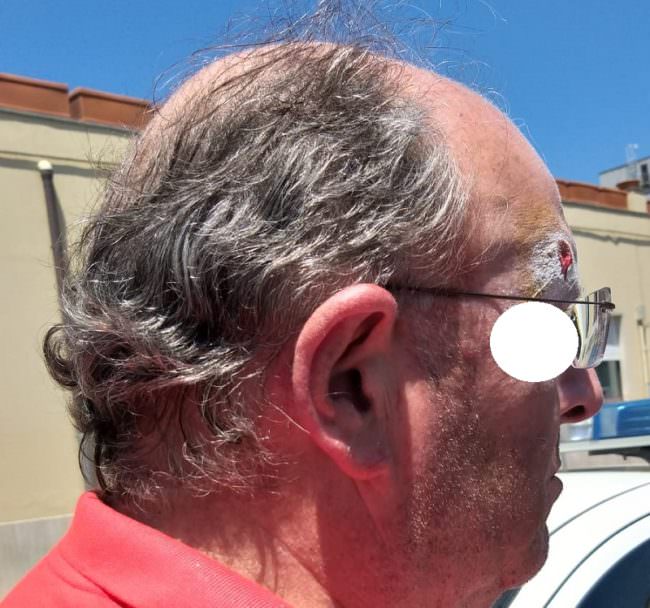 Catania, aggressione ai vigili urbani in corso Sicilia: ufficiale e ispettore presi a pugni in faccia durante alcuni controlli