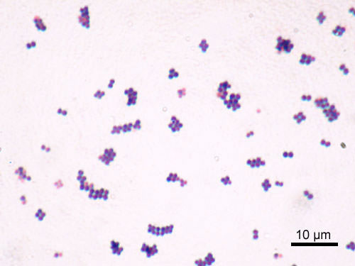 Spopola il batterio “staphylococcus aureus”: di cosa si tratta e i rischi che comporta