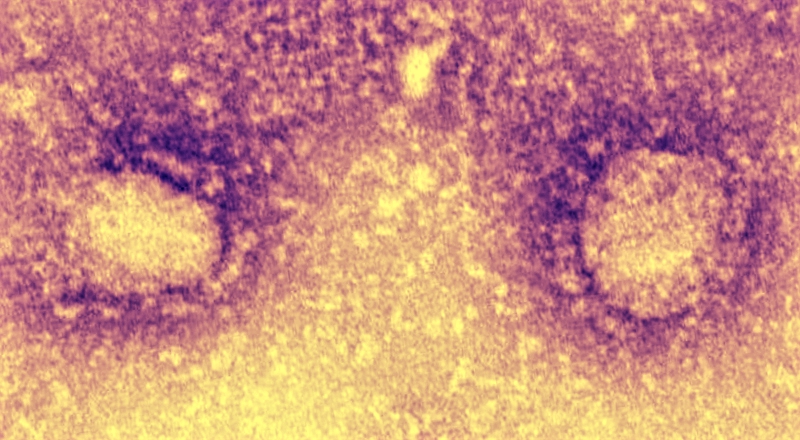 Il Coronavirus miete ancora vittime, ora anche in Europa: il primo decesso arriva dalla Francia