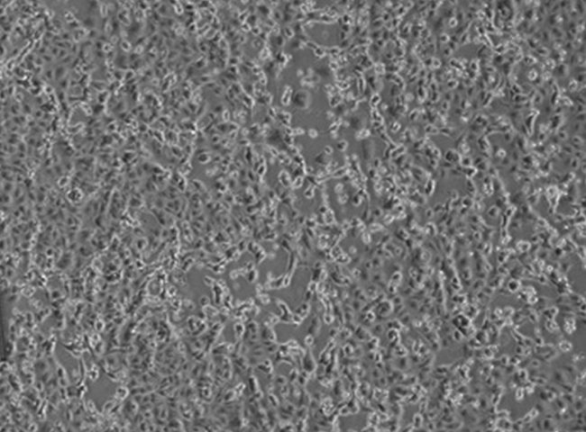 Coronavirus, positivo un italiano rimpatriato da Wuhan