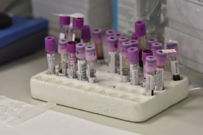 Coronavirus, c'e' un'ipotesi sui “pazienti zero” in Veneto