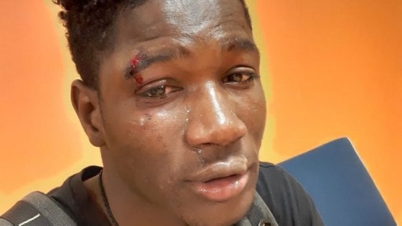 Giovane senegalese accerchiato e picchiato: indagati nove minorenni