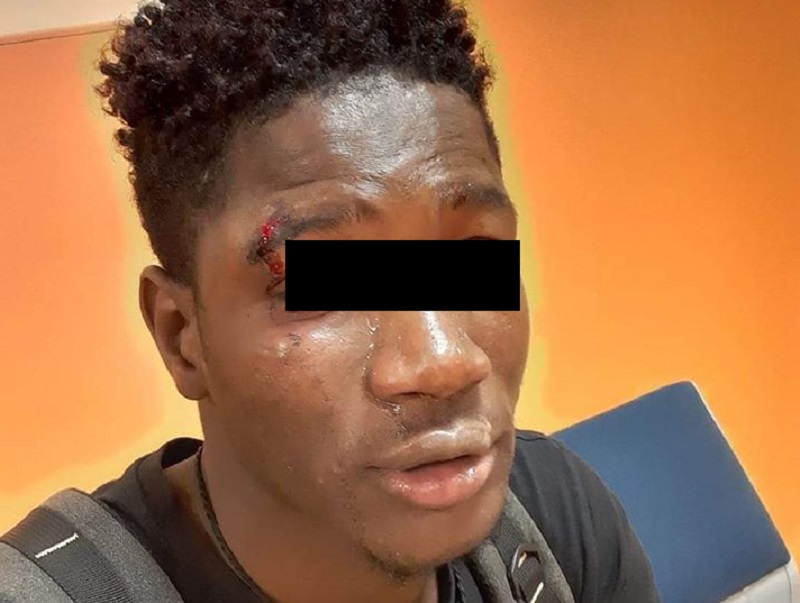 “Vai via da qui, ne**o di m***a”, accerchiato e picchiato da 30 adolescenti perché di colore: giovane ricoverato in ospedale