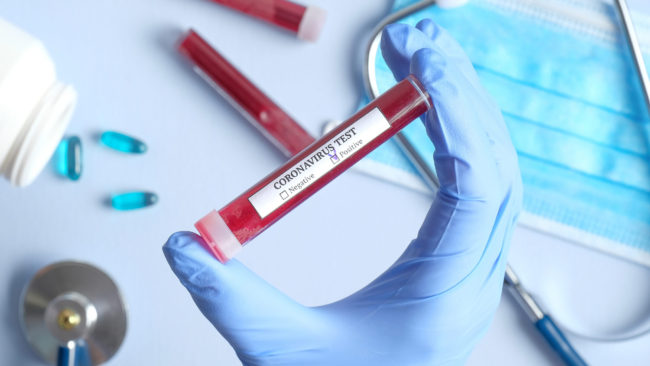 Coronavirus, salgono a 10 i casi di decesso della rsa di Villafrati: si tratta di una donna 88enne