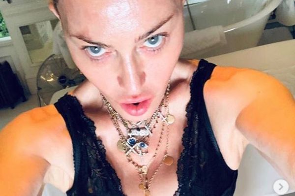 Madonna “Mi sottoporro' a un intervento di medicina rigenerativa”
