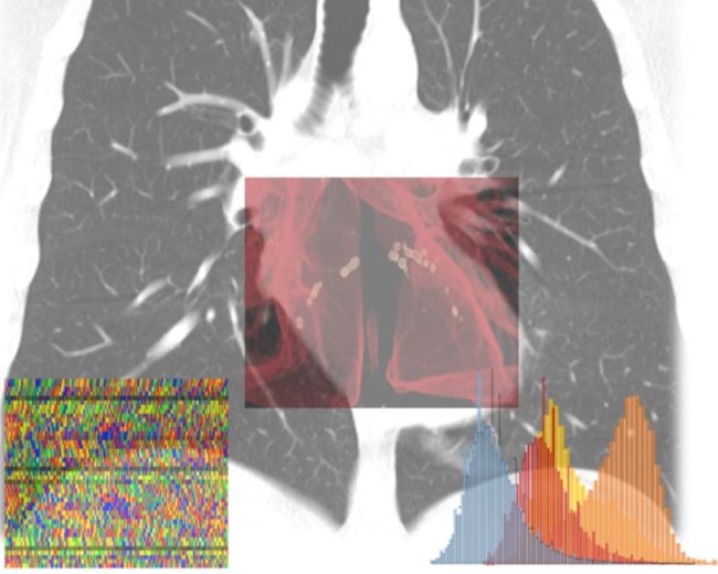 Ai-Score, l'intelligenza artificiale per calcolare il rischio Covid-19