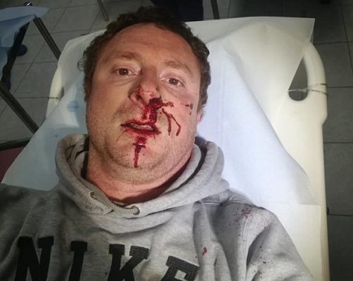 Distruggono il suo vigneto e lo picchiano: imprenditore vinicolo finisce al Pronto Soccorso