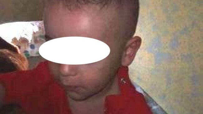 Morte piccolo Evan, eseguita l’autopsia: decesso causato da un trauma cranico