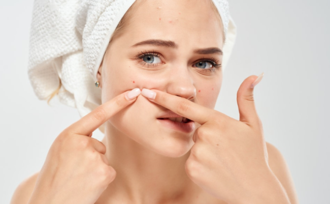 Acne e cura della pelle, cosa si può fare e cosa si dovrebbe evitare: i consigli dello specialista