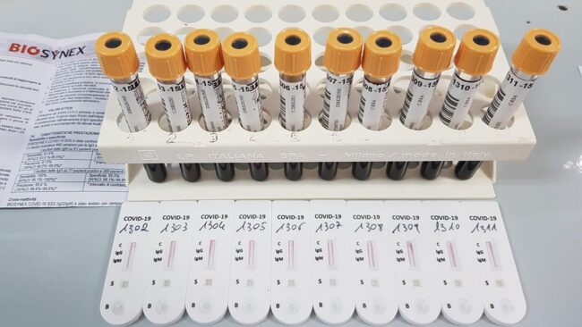 Coronavirus Catania, parla il sindaco di Bronte: “Decisione che ci addolora, ma necessaria. Rispettiamo regole”