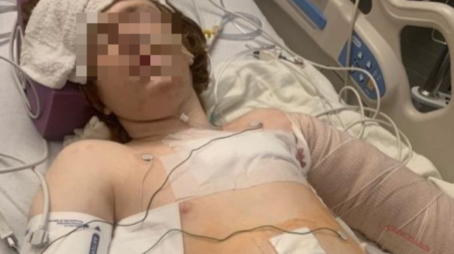 Bimbo autistico ha una crisi, la mamma chiede aiuto alla polizia: agenti aprono il fuoco