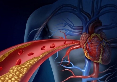 Svolta in medicina, due terapie per ridurre il colesterolo: in Italia troppi morti per malattie cardiovascolari – I DATI