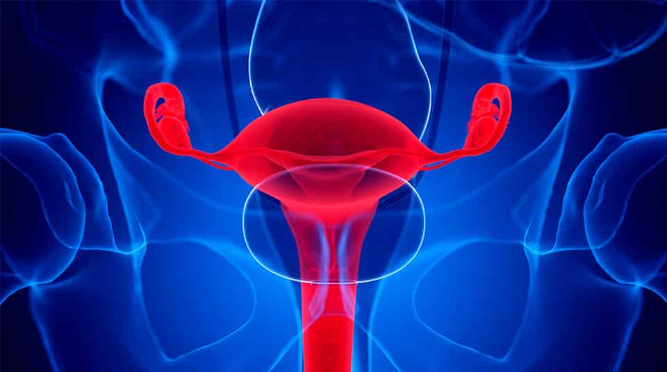 Carcinoma ovarico invasivo, compreso il meccanismo base delle metastasi