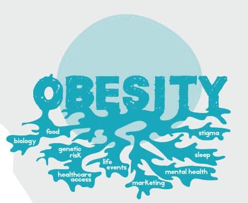 fattori obesità