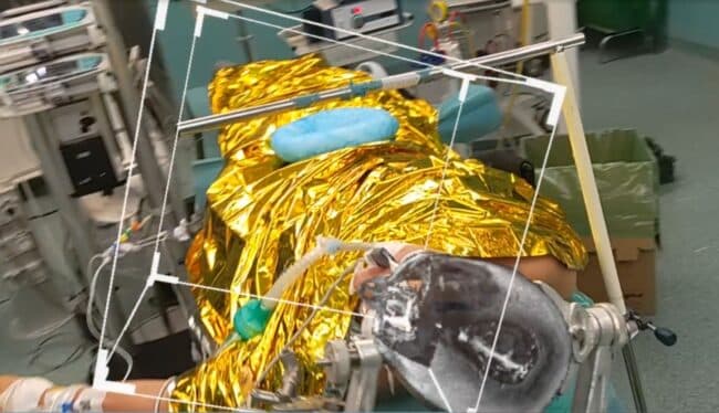 Ospedale Cannizzaro, la realtà aumentata entra in sala operatoria: ecco l’innovazione arrivata a Catania