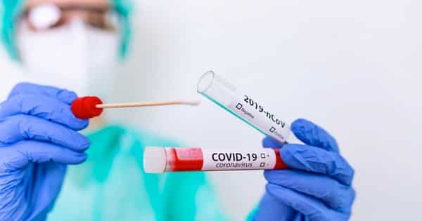Coronavirus Italia, 838 nuovi casi in 24 ore: i DATI aggiornati