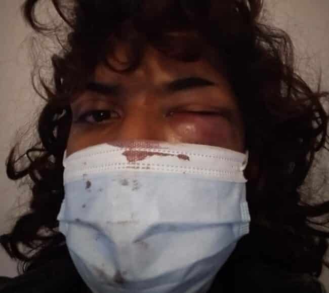 Catania, aggressione transfobica in centro. Zahira la vittima: “Dobbiamo fermare tutto ciò. Grata all’Arcigay”