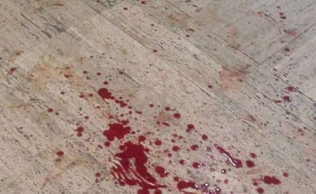 Varese, uccide il figlioletto di 7 anni e tenta di accoltellare l’ex moglie: fermato un 40enne