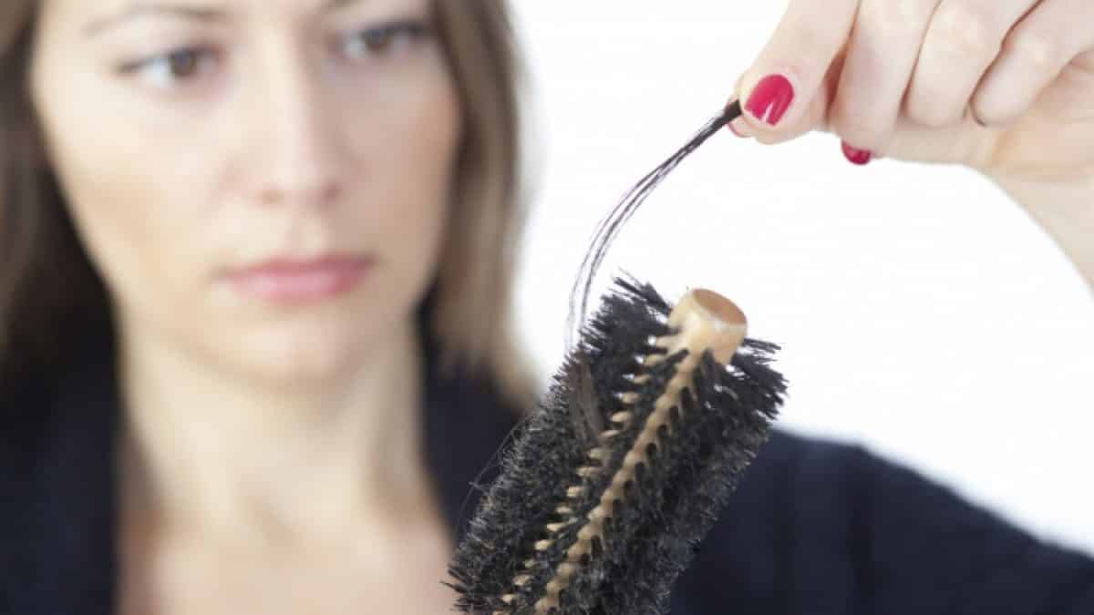 “Non avere capelli è stata una privazione del mio diritto di essere ragazza”: la storia di Martina che convive con l’Alopecia