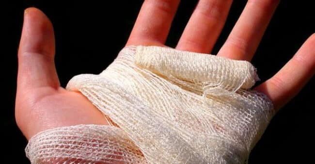 Litiga con il vicino che gli stacca il pollice con un morso: denunciato un pensionato