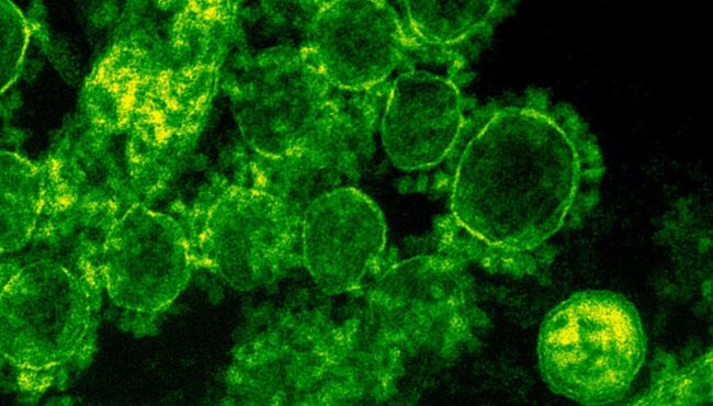 Riapre l’hotel Politeama chiuso per legionella: firmata ordinanza sindaco Lagalla e assessore Pennino