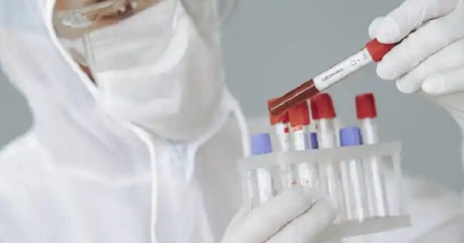 Influenza del cammello, al momento non c’è rischio nel Bel Paese. L’Iss: “Circolano tanti virus in Italia, ma non questo”