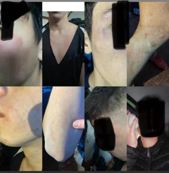 Scene di ordinaria follia in campo: botte fra ragazzini durante una partita di calcio in Sicilia