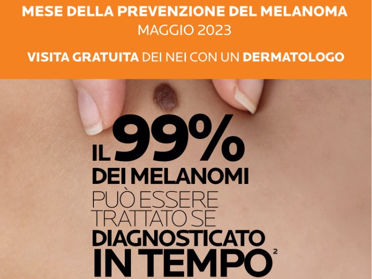 Campagna nazionale contro il melanoma, al Policlinico di Catania visite e consulenze gratuite