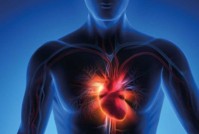 Scompenso cardiaco, in Sicilia le nuove terapie incontrano ancora inerzia terapeutica