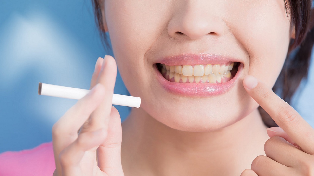 Impatto del fumo sull’accumulo di placca dentale, il nuovo studio CoEHAR dell’Università di Catania