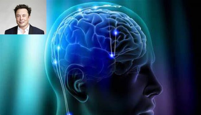 Neuralink, il nuovo progetto di Elon Musk sull’umanità: funzionerà?